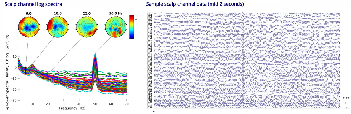 PR20221208_nemar_dataset.jpg